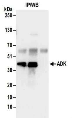 Immunoprecipitation: ADK Antibody [NBP2-32189]