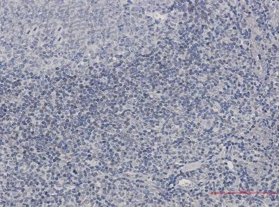 Immunohistochemistry-Paraffin: ADK Antibody (S05-0G0) [NBP3-19831]