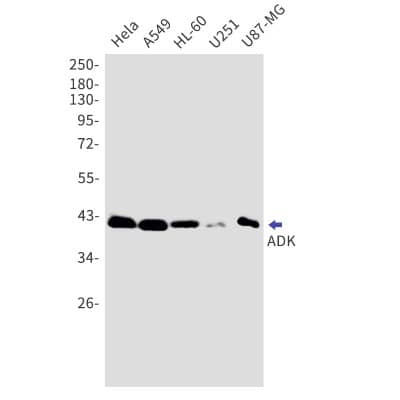 Western Blot: ADK Antibody (S05-0G0) [NBP3-19831]