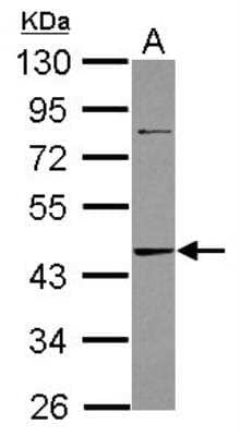 Western Blot: ADK Antibody [NBP1-31802]
