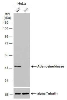 Western Blot: ADK Antibody [NBP1-31802]