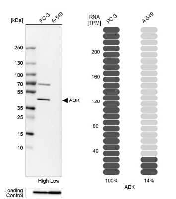 Western Blot: ADK Antibody [NBP1-90197]