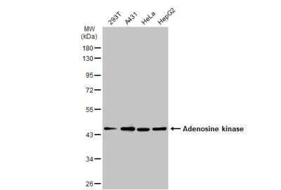 Western Blot: ADK Antibody [NBP2-15291]