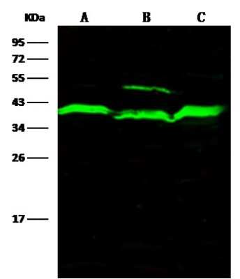 Western Blot: ADK Antibody [NBP3-00077]