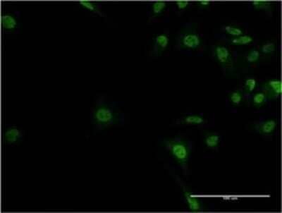 Immunocytochemistry/ Immunofluorescence: ADNP Antibody (2C5) [H00023394-M02]