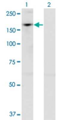 Western Blot: ADNP Antibody (2C5) [H00023394-M02]