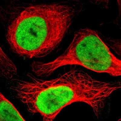 Immunocytochemistry/ Immunofluorescence: ADNP Antibody [NBP1-89236]