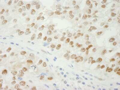 Immunohistochemistry: ADNP Antibody [NB110-40556]