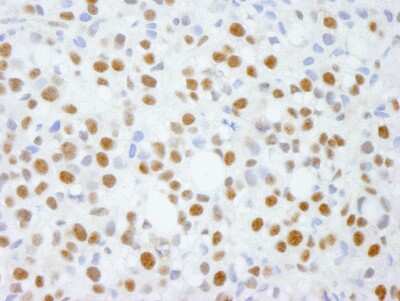 Immunohistochemistry: ADNP Antibody [NB110-40556]