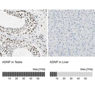 Immunohistochemistry-Paraffin: ADNP Antibody [NBP1-89236]