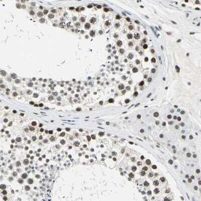 Immunohistochemistry-Paraffin: ADNP Antibody [NBP1-89236]