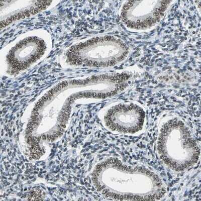 Immunohistochemistry-Paraffin: ADNP Antibody [NBP1-89236]