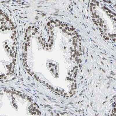 Immunohistochemistry-Paraffin: ADNP Antibody [NBP1-89236]
