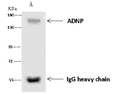 Immunoprecipitation: ADNP Antibody [NBP2-97747]
