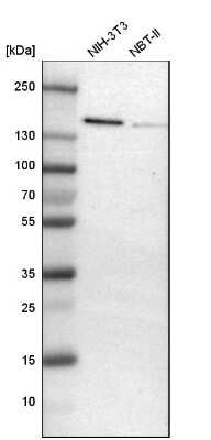 Western Blot: ADNP Antibody [NBP1-89236]