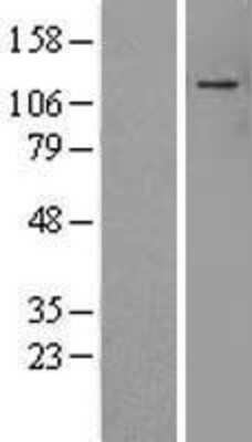 Western Blot: ADNP Overexpression Lysate [NBL1-07346]