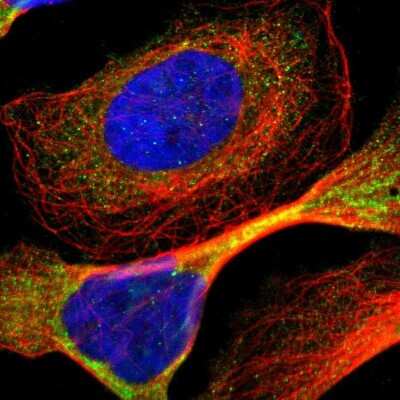 Immunocytochemistry/ Immunofluorescence: ADNP2 Antibody [NBP1-81468]