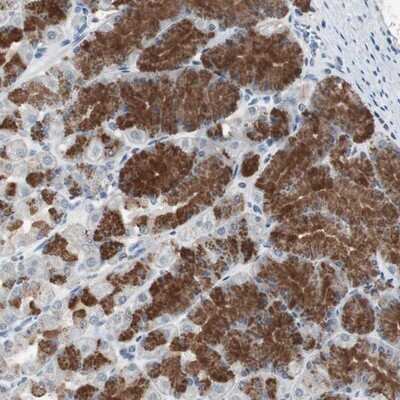 Immunohistochemistry-Paraffin: ADNP2 Antibody [NBP1-81468]