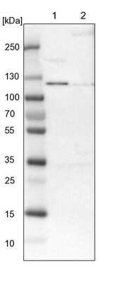 Western Blot: ADNP2 Antibody [NBP1-81468]