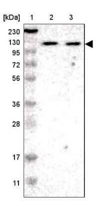 Western Blot: ADNP2 Antibody [NBP1-81468]