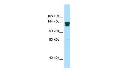 Western Blot: ADNP2 Antibody [NBP2-82582]