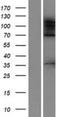 Western Blot: ADNP2 Overexpression Lysate [NBP2-07253]