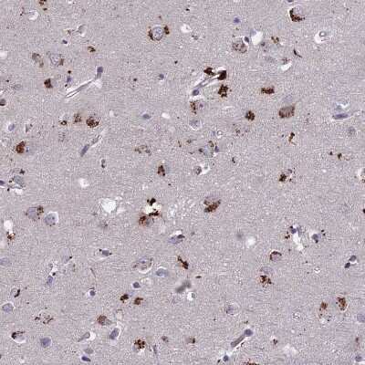 Immunohistochemistry-Paraffin: ADO Antibody [NBP1-88530]