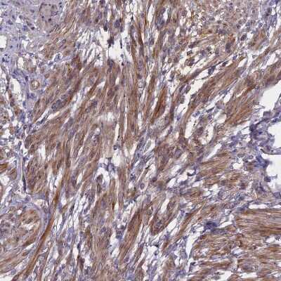 Immunohistochemistry-Paraffin: ADO Antibody [NBP1-88530]