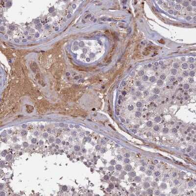 Immunohistochemistry-Paraffin: ADO Antibody [NBP1-88530]