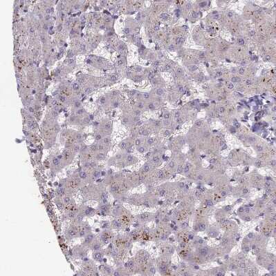 Immunohistochemistry-Paraffin: ADO Antibody [NBP1-88530]