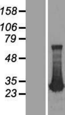 Western Blot: ADO Overexpression Lysate [NBL1-07348]