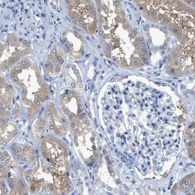 Immunohistochemistry: ADP-Sugar Pyrophosphatase/NUDT5 Antibody [NBP1-83131]