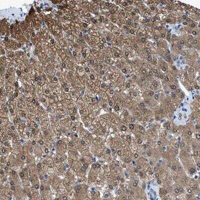 Immunohistochemistry-Paraffin: ADP-Sugar Pyrophosphatase/NUDT5 Antibody [NBP1-83131]
