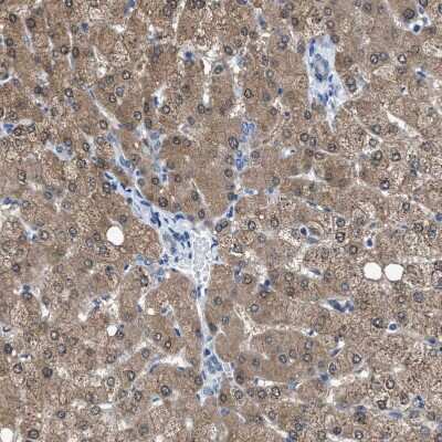 Immunohistochemistry-Paraffin: ADP-Sugar Pyrophosphatase/NUDT5 Antibody [NBP1-83131]