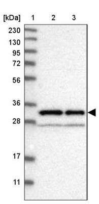 Western Blot: ADP-Sugar Pyrophosphatase/NUDT5 Antibody [NBP1-83131]