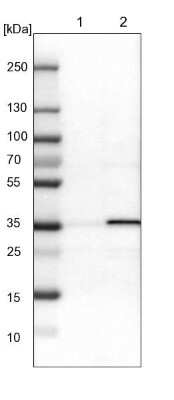 Western Blot: ADP-Sugar Pyrophosphatase/NUDT5 Antibody [NBP1-83131]