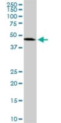 Western Blot: ADP-ribosylarginine hydrolase Antibody (1F11) [H00000141-M04]