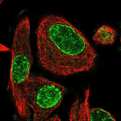 Immunocytochemistry/ Immunofluorescence: ADP-ribosylarginine hydrolase Antibody [NBP2-55160]