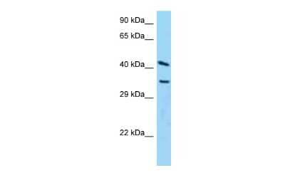 Western Blot: ADP-ribosylarginine hydrolase Antibody [NBP2-84402]