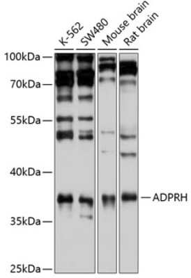 Western Blot: ADP-ribosylarginine hydrolase AntibodyBSA Free [NBP2-92469]