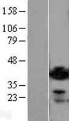 Western Blot: ADP-ribosylarginine hydrolase Overexpression Lysate [NBL1-07354]