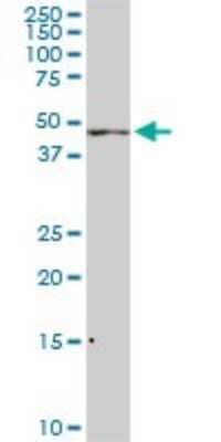 Western Blot: ADPGK Antibody (1E4) [H00083440-M01]