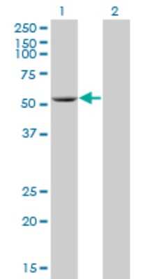 Western Blot: ADPGK Antibody (1E4) [H00083440-M01]