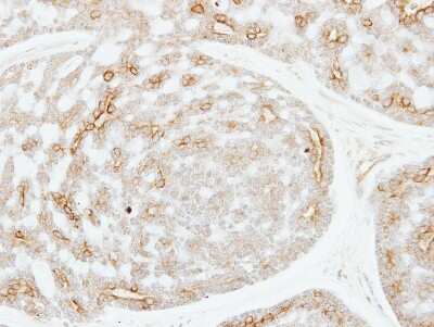 Immunohistochemistry-Paraffin: ADPGK Antibody [NBP1-32429]