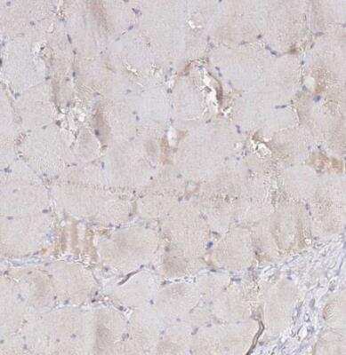 Immunohistochemistry-Paraffin: ADPGK Antibody [NBP1-91653]