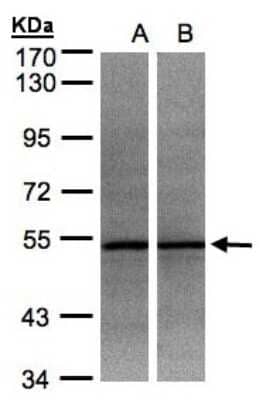 Western Blot: ADPGK Antibody [NBP1-32429]