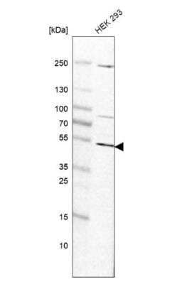 Western Blot: ADPGK Antibody [NBP1-91653]