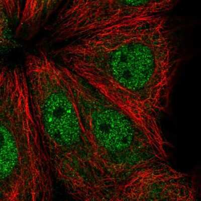 Immunocytochemistry/ Immunofluorescence: ADPRHL1 Antibody [NBP2-39073]