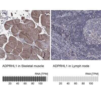 Immunocytochemistry/ Immunofluorescence: ADPRHL1 Antibody [NBP3-17098]