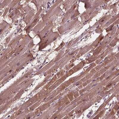 Immunohistochemistry-Paraffin: ADPRHL1 Antibody [NBP2-39073]